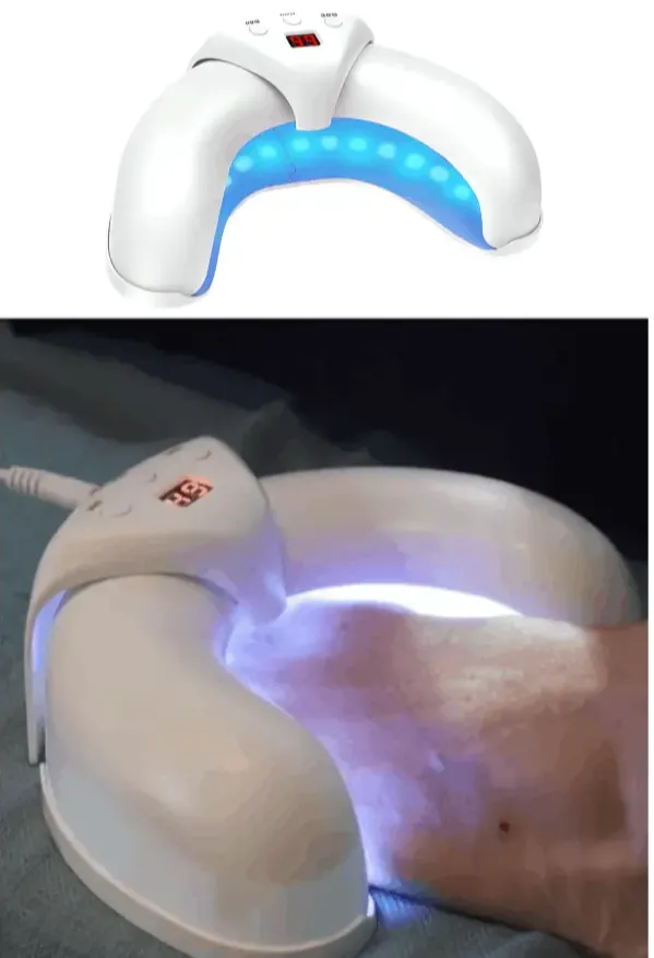 Lumonail Nail Fungus