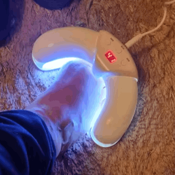 Lumonail Nail Fungus customer - Robert M. ~ Florida, USA